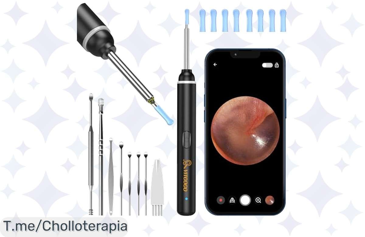 ¡Cuida tu salud auditiva con el revolucionario Otoscopio WIFI VITCOCO!