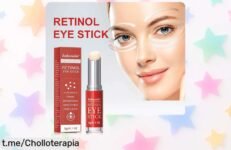 Crema de ojos con retinol que aclara ojeras y reafirma la piel al instante, ¡no te pierdas esta ganga a precio loco! Solo por tiempo limitado, asegura tu piel fresca y radiante antes de que desaparezca este super chollo.