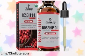 Aceite de rosa mosqueta Kanzy 120ml prensado en frío a precio rebajado para cicatrices e hidratación, ¡aprovecha este super chollo y siente tu piel más suave ya!