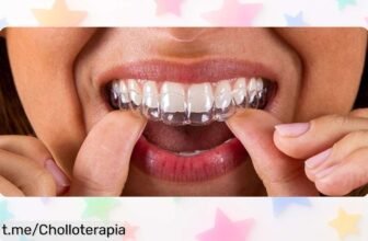 Transforma tu sonrisa con los alineadores invisibles Impress y ahorra 300€ en el proceso, ¡no dejes escapar esta promoción antes de que se esfume!
