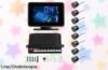 Sensor de aparcamiento SIXRUN con pantalla LCD, ahora a un precio de ganga que no vas a querer dejar pasar: ¡seguridad en cada giro y tu coche protegido ya!