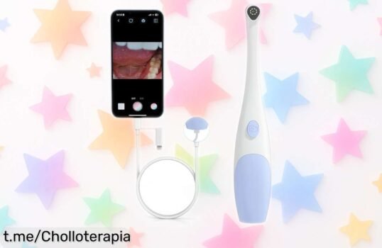 Endoscopio cámara oral HD para mascotas: descubre sus dientes con claridad impresionante y una conexión fácil al móvil. ¡No dejes pasar este precio de ganga único!