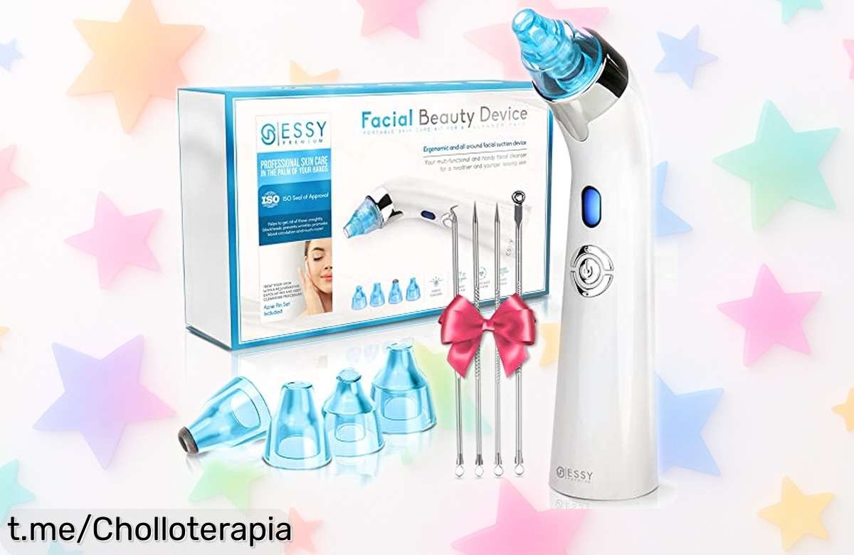 Succionador de puntos negros y espinillas Essy: ¡kit completo para una limpieza facial fácil a un precio regalado que no querrás dejar pasar!